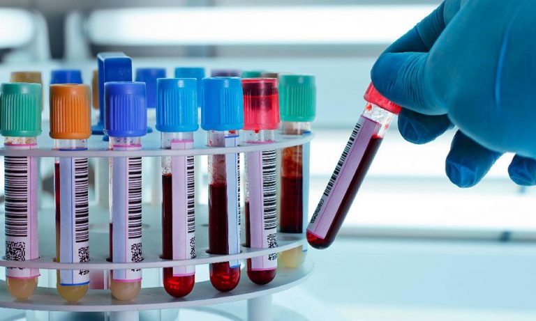 Diecinueve laboratorios harán testeo para diagnosticar coronavirus