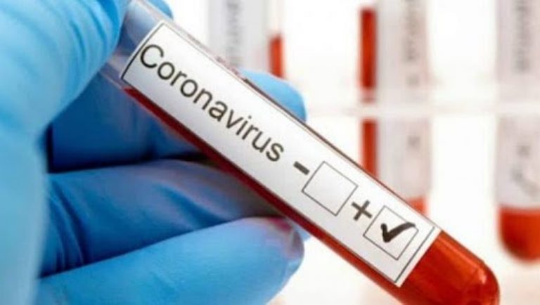 Junín confirma 66 casos positivos de Coronavirus