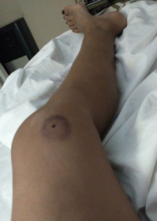 Competidora de atletismo es herida en una pierna en un hecho de ‘violencia de género’