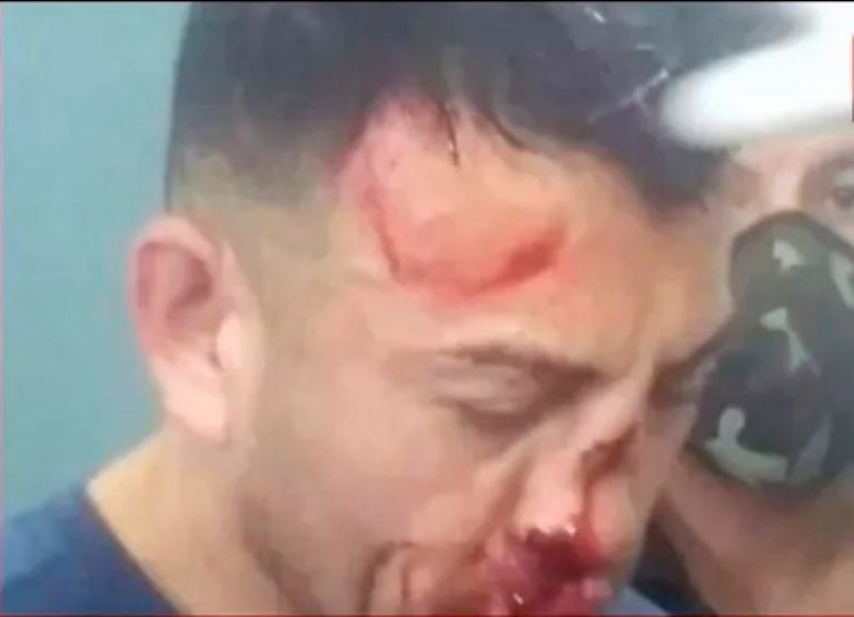 En Los Toldos se valoró el trabajo policial para esclarecer el femicidio de Analía Maldonado