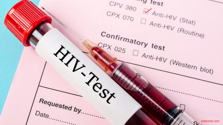El 40% de los nuevos diagnósticos de HIV tenían o habían tenido Sífilis