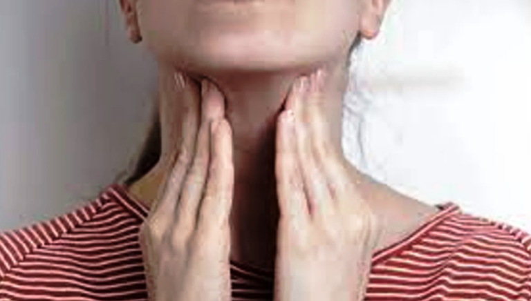 Mononucleosis: qué es y cómo se transmite esta enfermedad