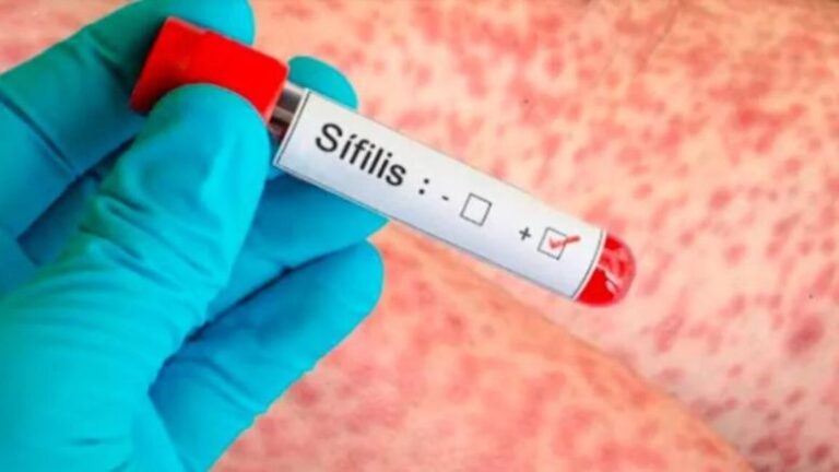 Aumentaron un 71% los casos de sífilis