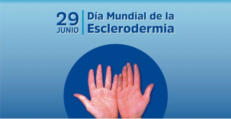Día Mundial de la Esclerodermia: una jornada para visibilizar una enfermedad poco frecuente y promover el diagnóstico temprano